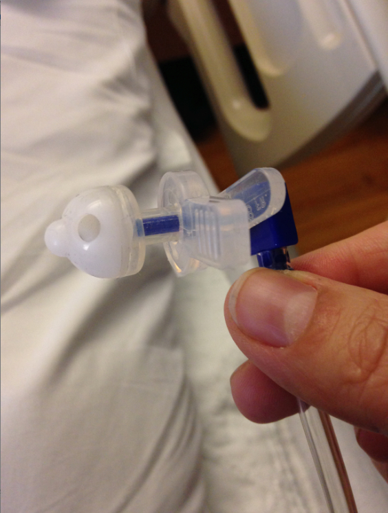 Microvasive G Tube PEG
